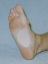 ADHESIVE PADDINGS.