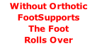 Without Orthotic FootSupports  The Foot  Rolls Over